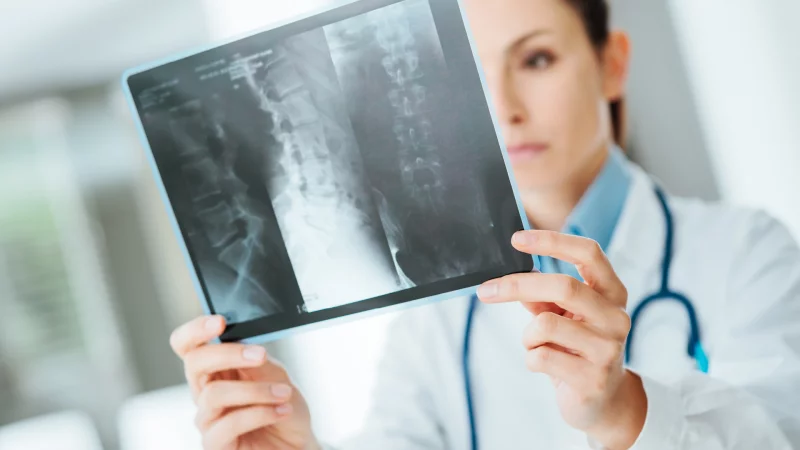 Zasady profilaktyki, rozpoznawania i leczenia osteoporotycznych złamań kości